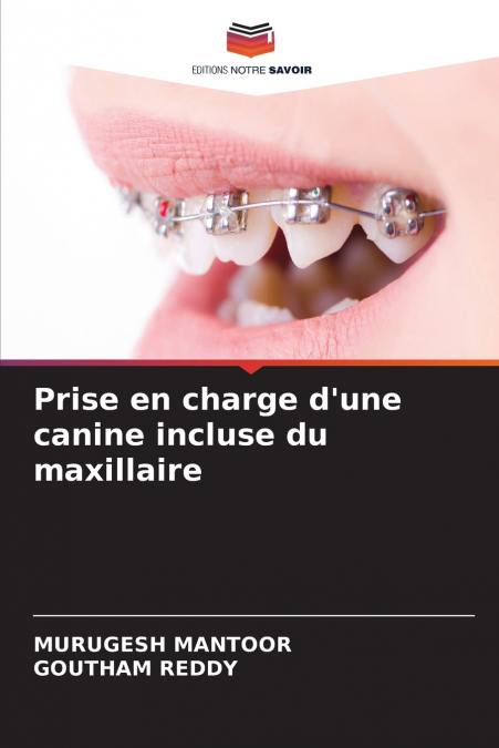 Prise en charge d’une canine incluse du maxillaire