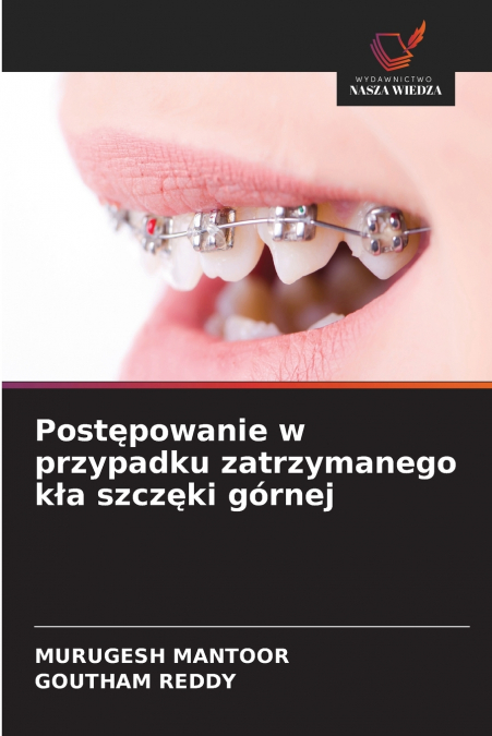 Postępowanie w przypadku zatrzymanego kła szczęki górnej