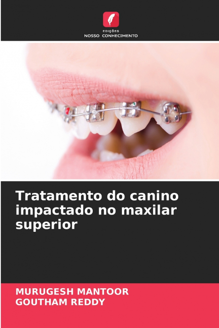 Tratamento do canino impactado no maxilar superior