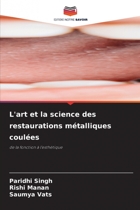 L’art et la science des restaurations métalliques coulées