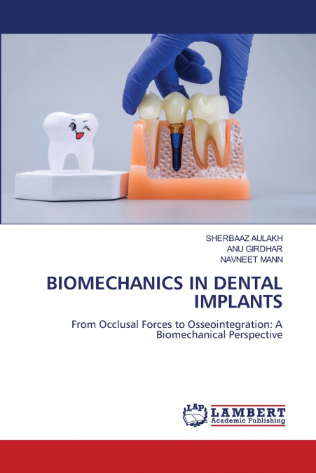 BIOMECHANICS IN DENTAL IMPLANTS