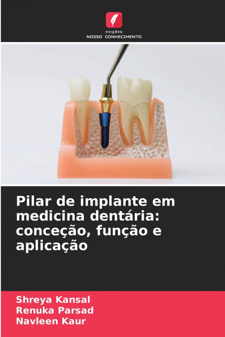 Pilar de implante em medicina dentária
