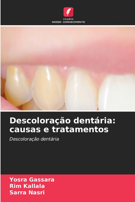 Descoloração dentária