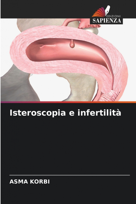 Isteroscopia e infertilità