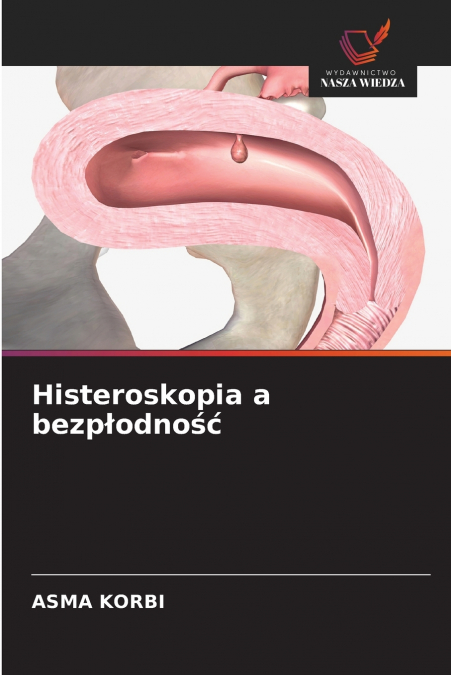 Histeroskopia a bezpłodność