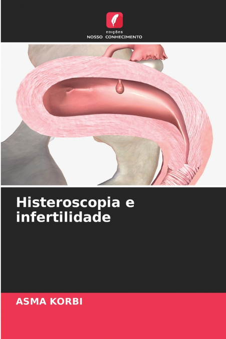 Histeroscopia e infertilidade