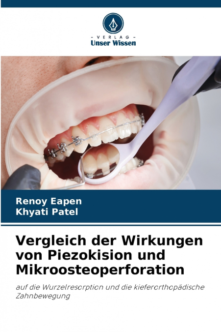 Vergleich der Wirkungen von Piezokision und Mikroosteoperforation