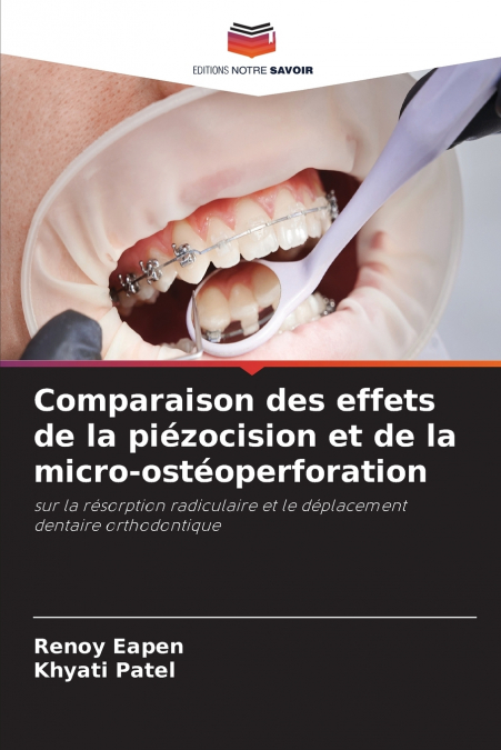 Comparaison des effets de la piézocision et de la micro-ostéoperforation