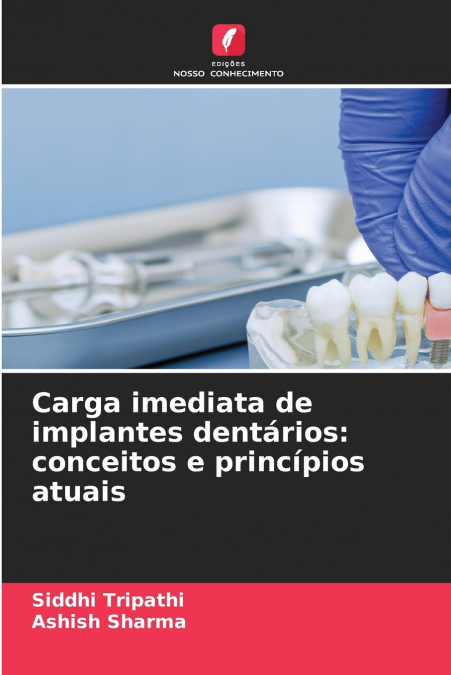Carga imediata de implantes dentários