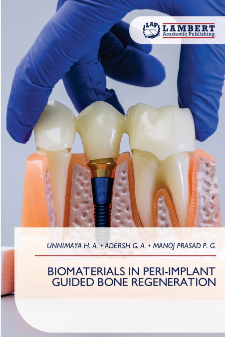 BIOMATERIALS IN PERI-IMPLANT GUIDED BONE REGENERATION