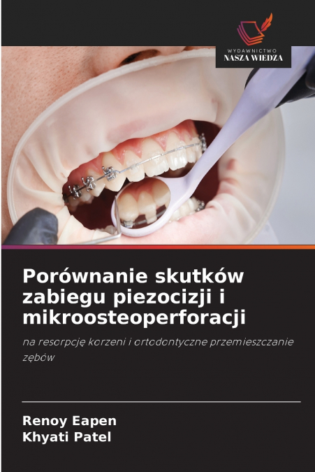 Porównanie skutków zabiegu piezocizji i mikroosteoperforacji