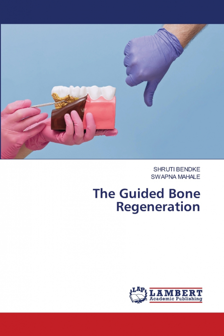 The Guided Bone Regeneration