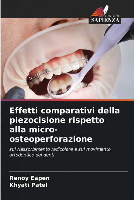 Effetti comparativi della piezocisione rispetto alla micro-osteoperforazione