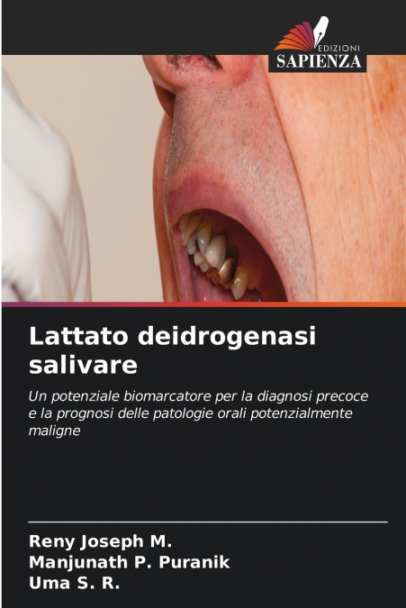 Lattato deidrogenasi salivare