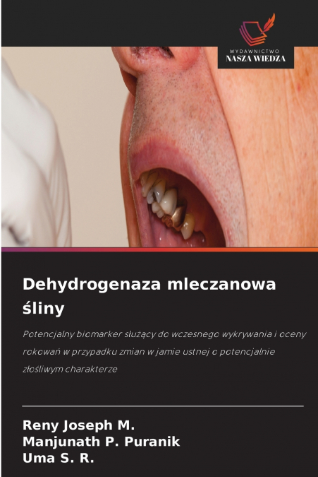 Dehydrogenaza mleczanowa śliny