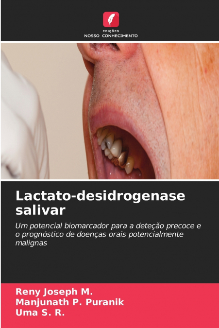 Lactato-desidrogenase salivar