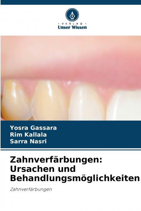 Zahnverfärbungen