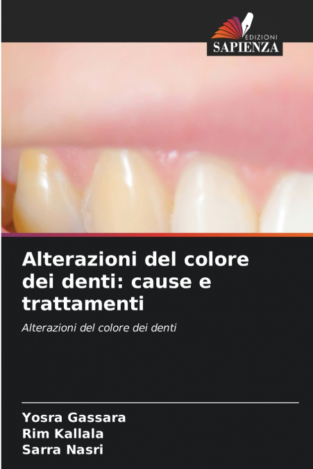 Alterazioni del colore dei denti