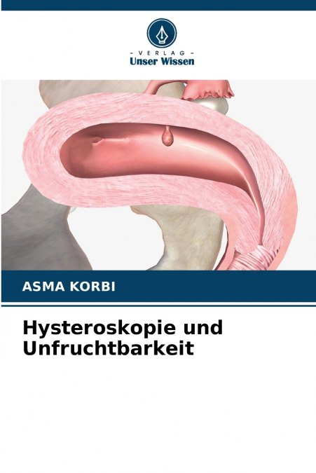 Hysteroskopie und Unfruchtbarkeit