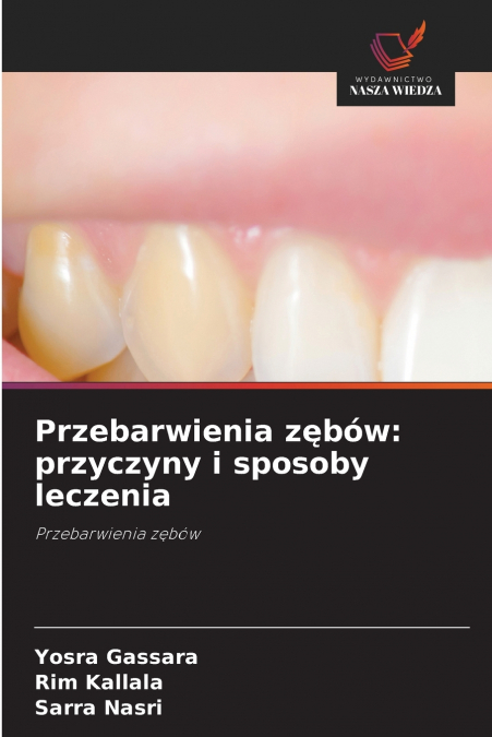 Przebarwienia zębów