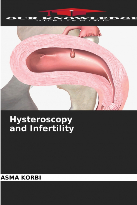 Hysteroscopy and Infertility