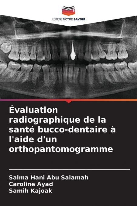 Évaluation radiographique de la santé bucco-dentaire à l’aide d’un orthopantomogramme