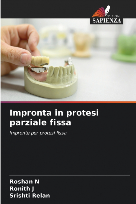 Impronta in protesi parziale fissa