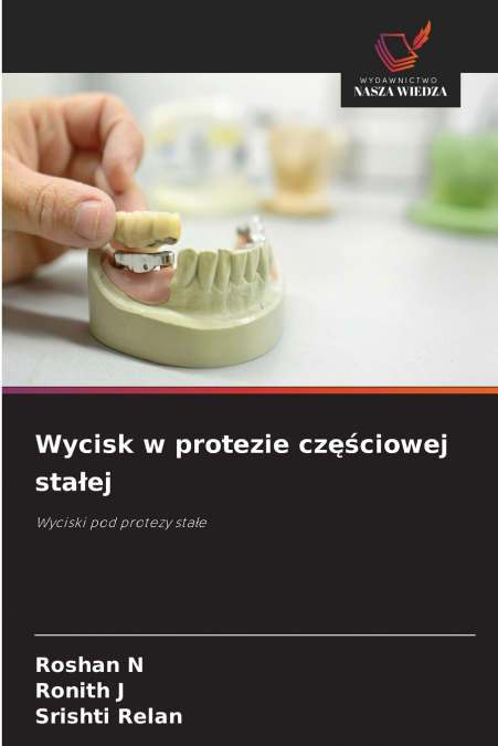 Wycisk w protezie częściowej stałej