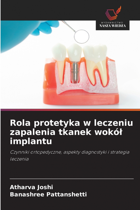 Rola protetyka w leczeniu zapalenia tkanek wokół implantu