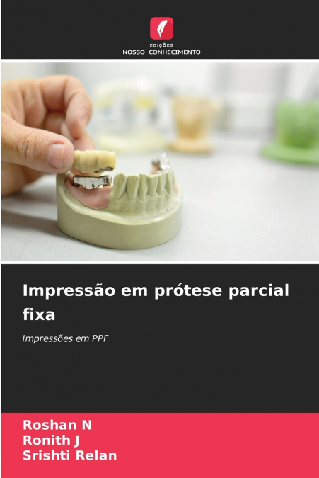 Impressão em prótese parcial fixa