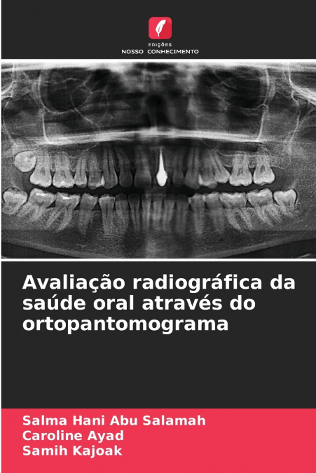 Avaliação radiográfica da saúde oral através do ortopantomograma