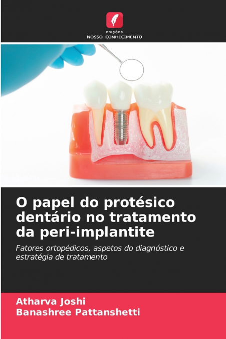O papel do protésico dentário no tratamento da peri-implantite
