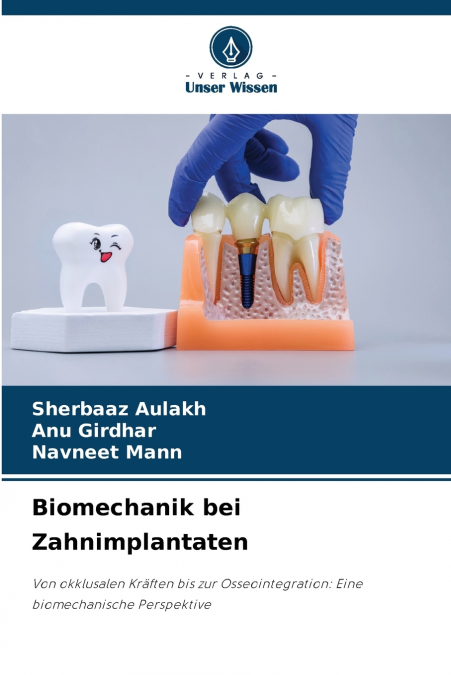 Biomechanik bei Zahnimplantaten