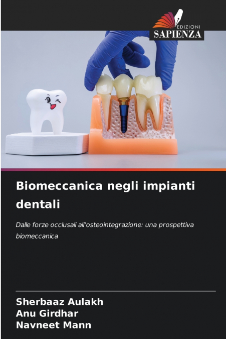Biomeccanica negli impianti dentali