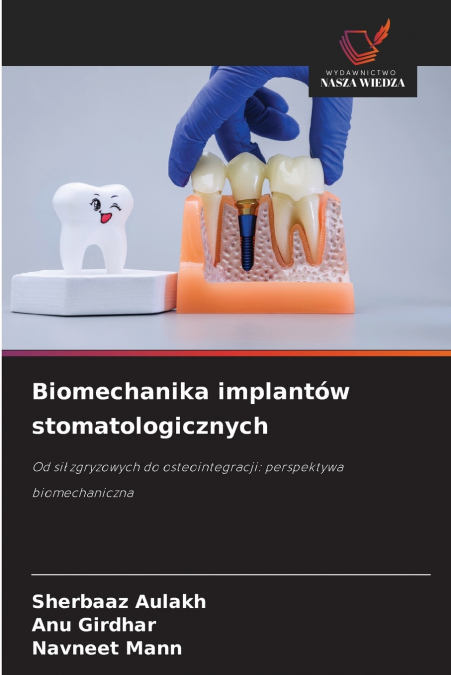 Biomechanika implantów stomatologicznych