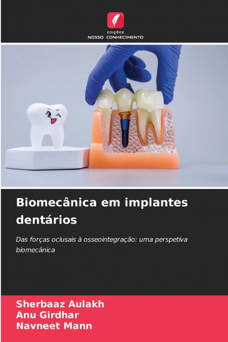 Biomecânica em implantes dentários