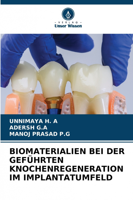 BIOMATERIALIEN BEI DER GEFÜHRTEN KNOCHENREGENERATION IM IMPLANTATUMFELD