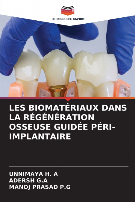 LES BIOMATÉRIAUX DANS LA RÉGÉNÉRATION OSSEUSE GUIDÉE PÉRI-IMPLANTAIRE