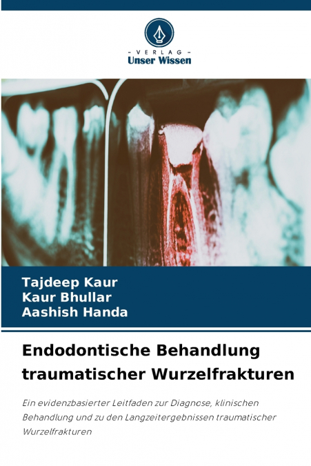 Endodontische Behandlung traumatischer Wurzelfrakturen
