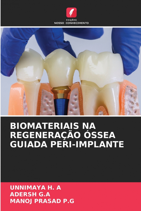 BIOMATERIAIS NA REGENERAÇÃO ÓSSEA GUIADA PERI-IMPLANTE