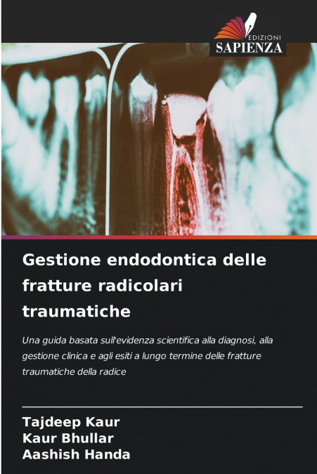 Gestione endodontica delle fratture radicolari traumatiche