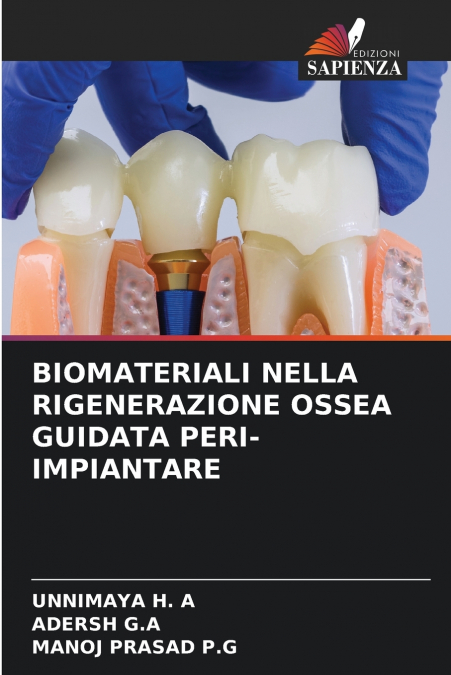 BIOMATERIALI NELLA RIGENERAZIONE OSSEA GUIDATA PERI-IMPIANTARE