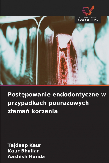 Postępowanie endodontyczne w przypadkach pourazowych złamań korzenia