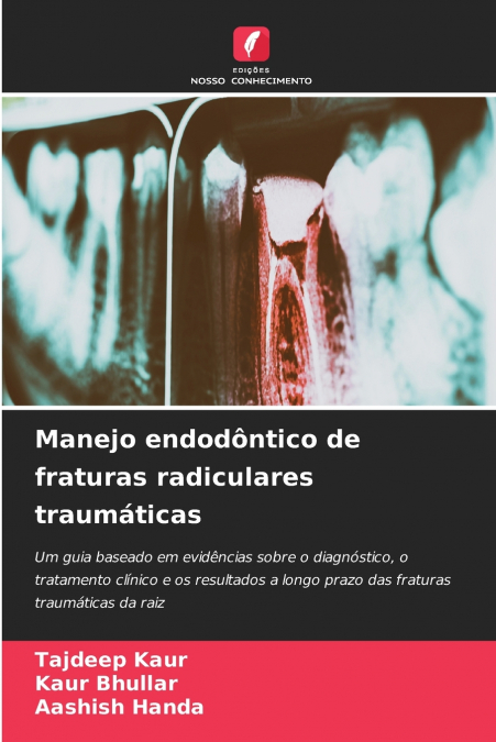 Manejo endodôntico de fraturas radiculares traumáticas