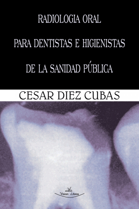 Radiología oral para dentistas e higienistas de la sanidad pública