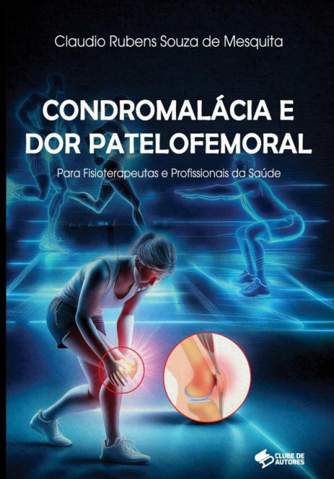 Condromalácia E Dor Patelofemoral