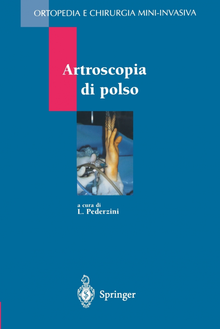 Artroscopia Di Polso