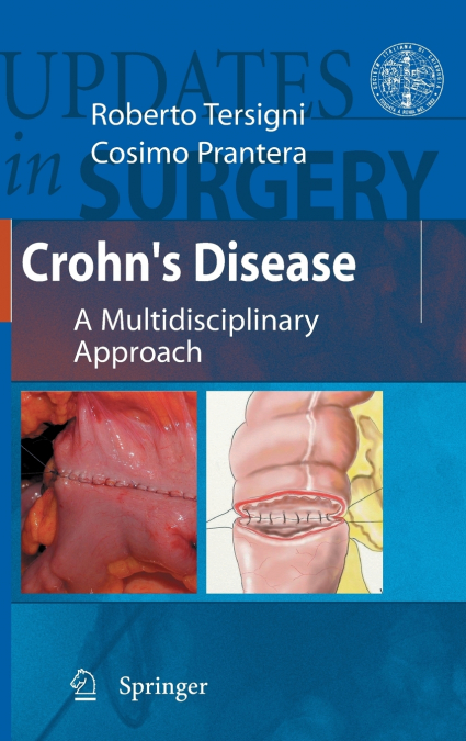 Crohn’s Disease