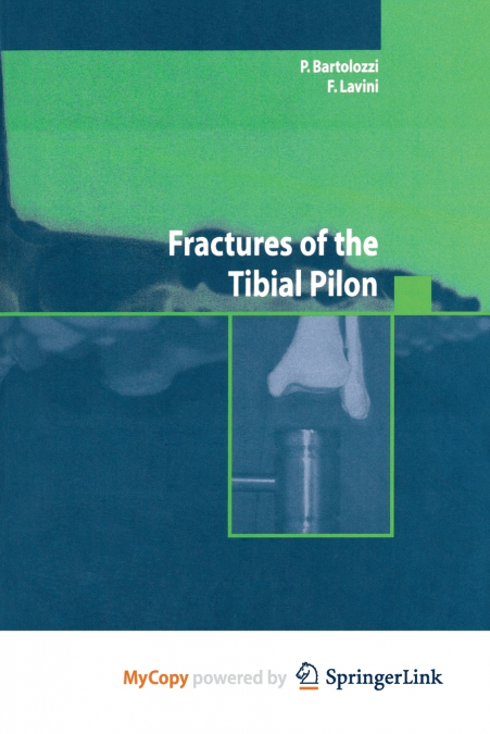 Fractures of the Tibial Pilon