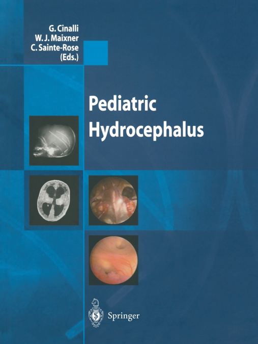 Pediatric Hydrocephalus